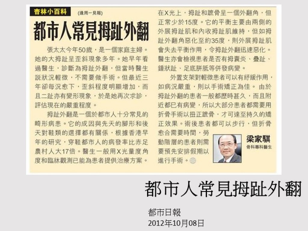 121008_都市人常見拇趾外翻_都市日報