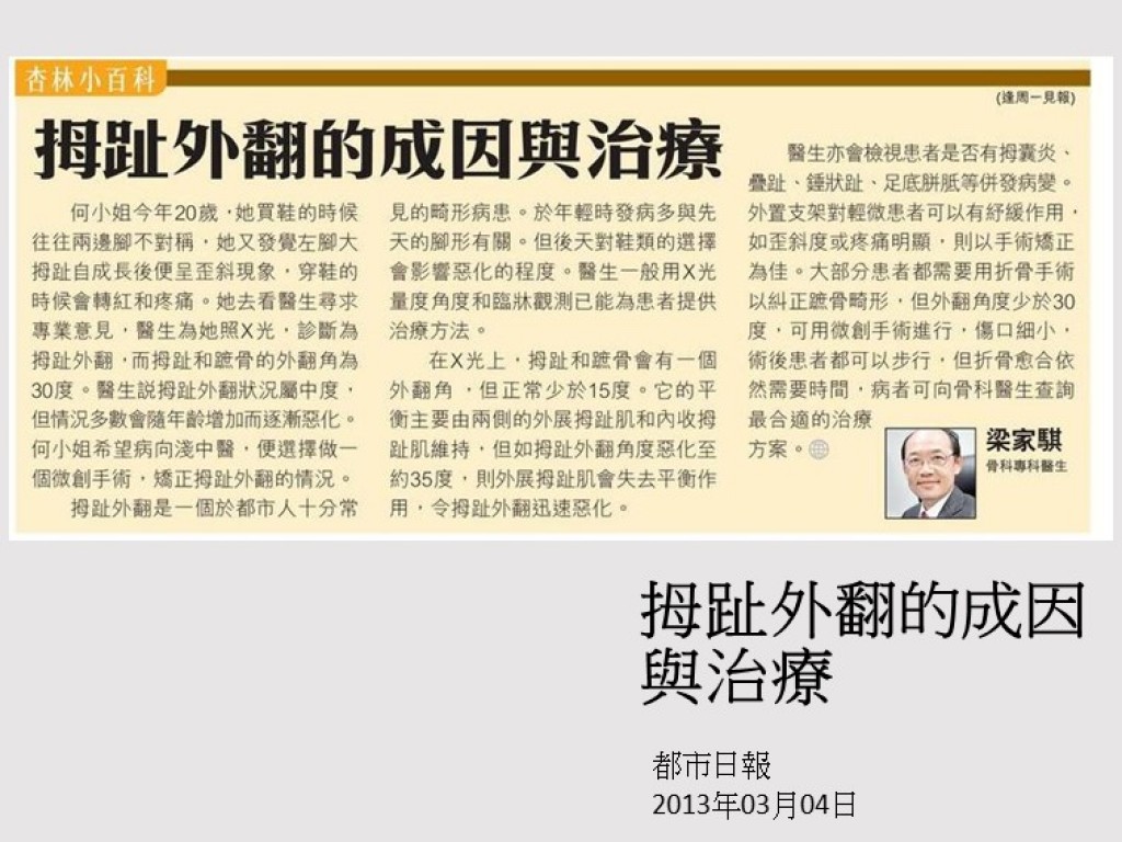 130304_拇趾外翻的成因與治療_都市日報