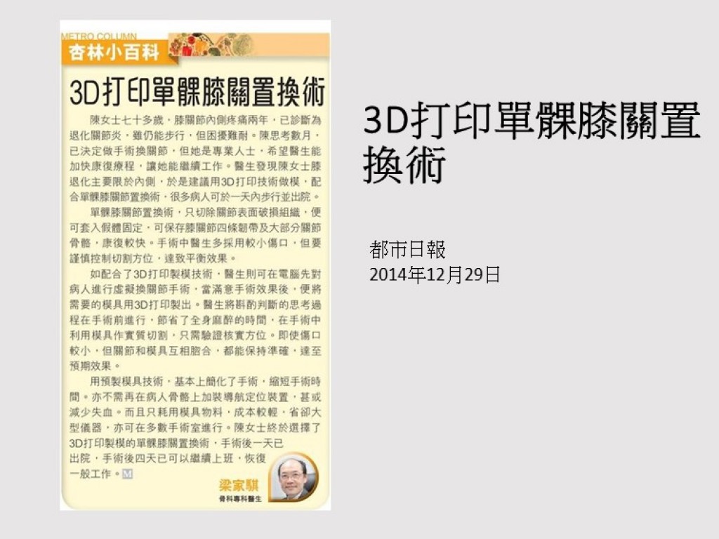141229_3D打印單髁膝關置換術_都市日報