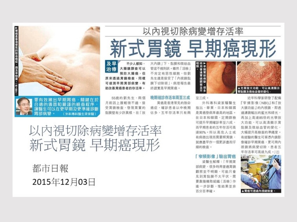 151203_以內視切除病變增存活率_新式胃鏡 早期癌現形_都市日報