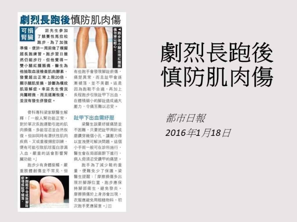 160118_劇烈長跑後_慎防肌肉傷_都市日報