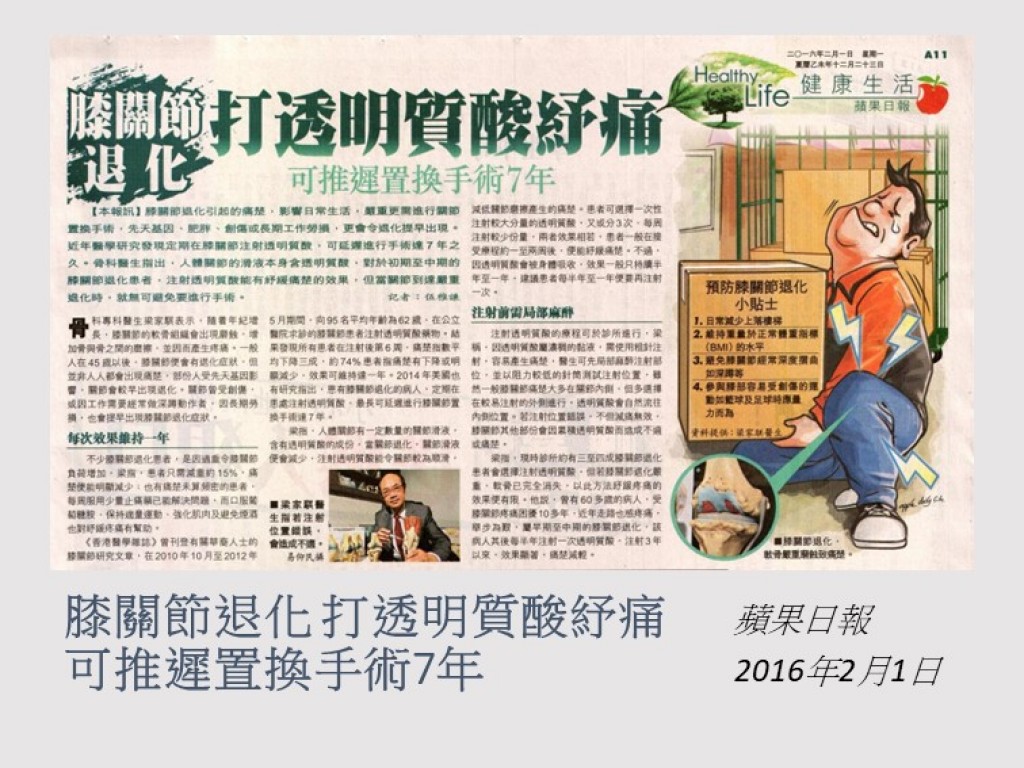 160201_膝關節退化_打透明質酸紓痛_可推遲置換手術7年_蘋果日報