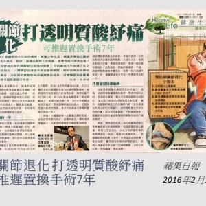 160201_膝關節退化_打透明質酸紓痛_可推遲置換手術7年_蘋果日報