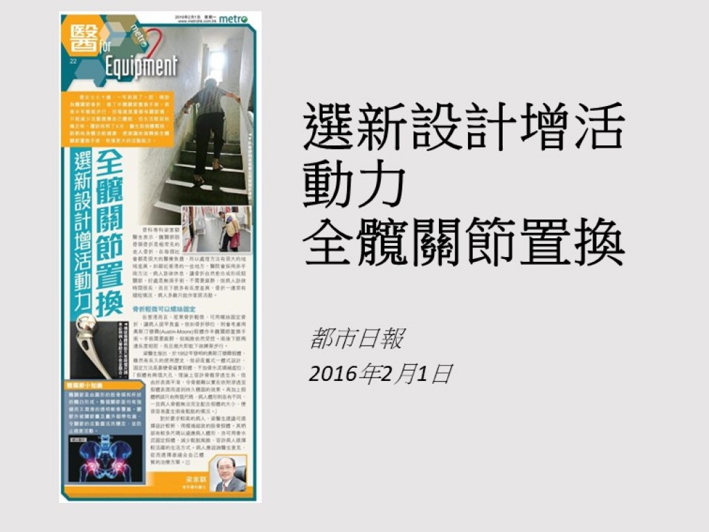 160201_選新設計增活動力_全髖關節置換_都市日報