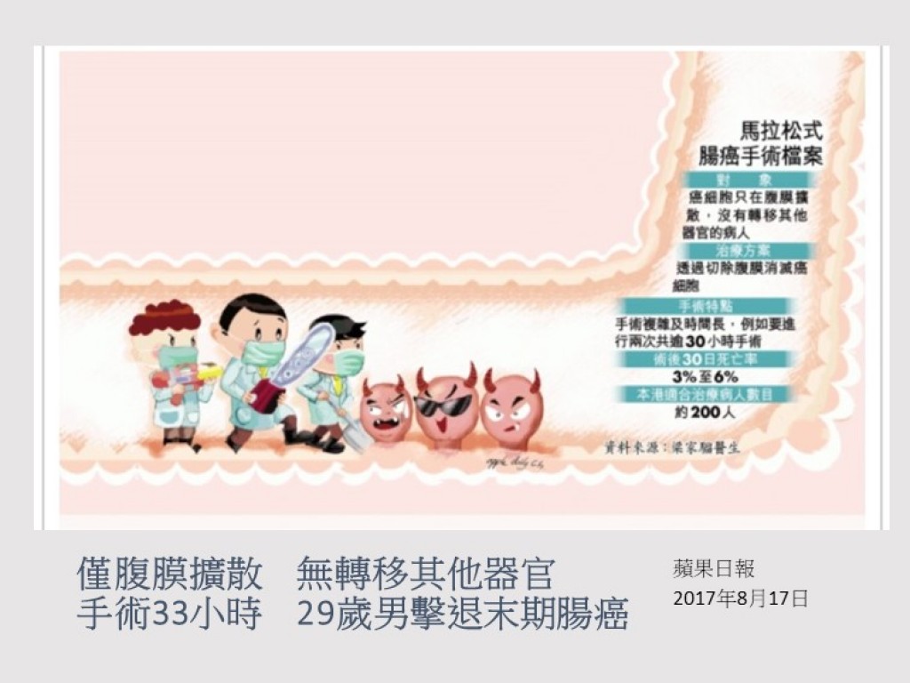 170817_手術33小時_僅腹膜擴散_無轉移其他器官_29歲男擊退末期腸癌_蘋果日報