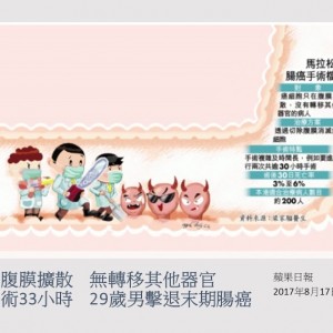 170817_手術33小時_僅腹膜擴散_無轉移其他器官_29歲男擊退末期腸癌_蘋果日報