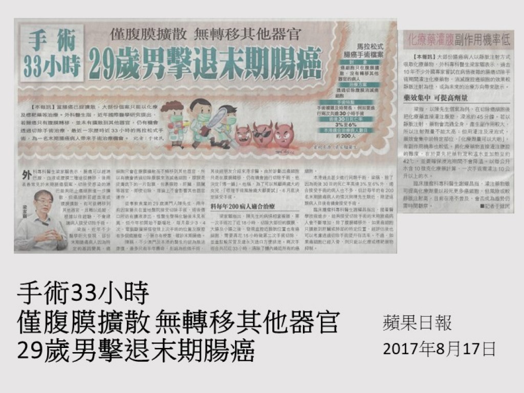 170817_手術33小時_僅腹膜擴散_無轉移其他器官_29歲男擊退末期腸癌_蘋果日報_印刷版