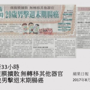 170817_手術33小時_僅腹膜擴散_無轉移其他器官_29歲男擊退末期腸癌_蘋果日報_印刷版