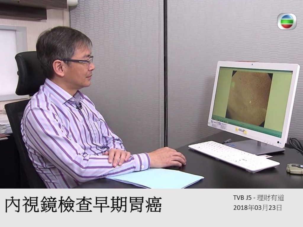 180323_內視鏡檢查早期胃癌_tvbj5理財有道