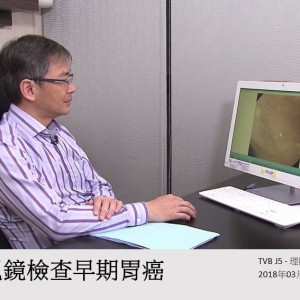 180323_內視鏡檢查早期胃癌_tvbj5理財有道