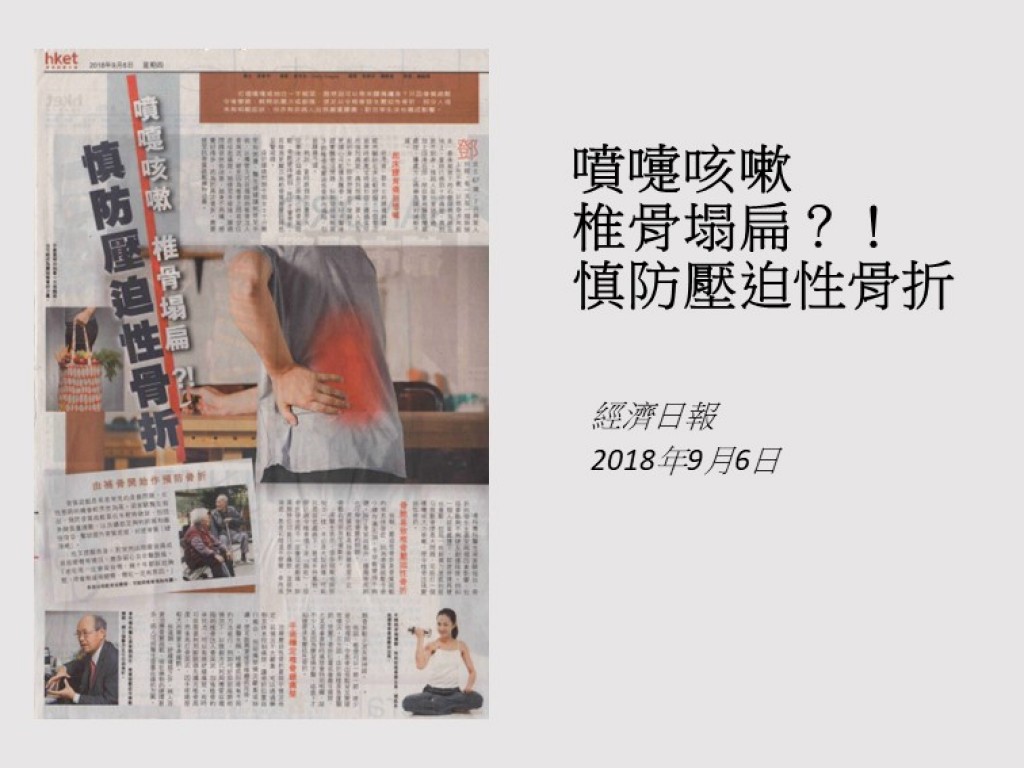 180906_噴嚏咳嗽_椎骨塌扁_慎防壓迫性骨折_經濟日報