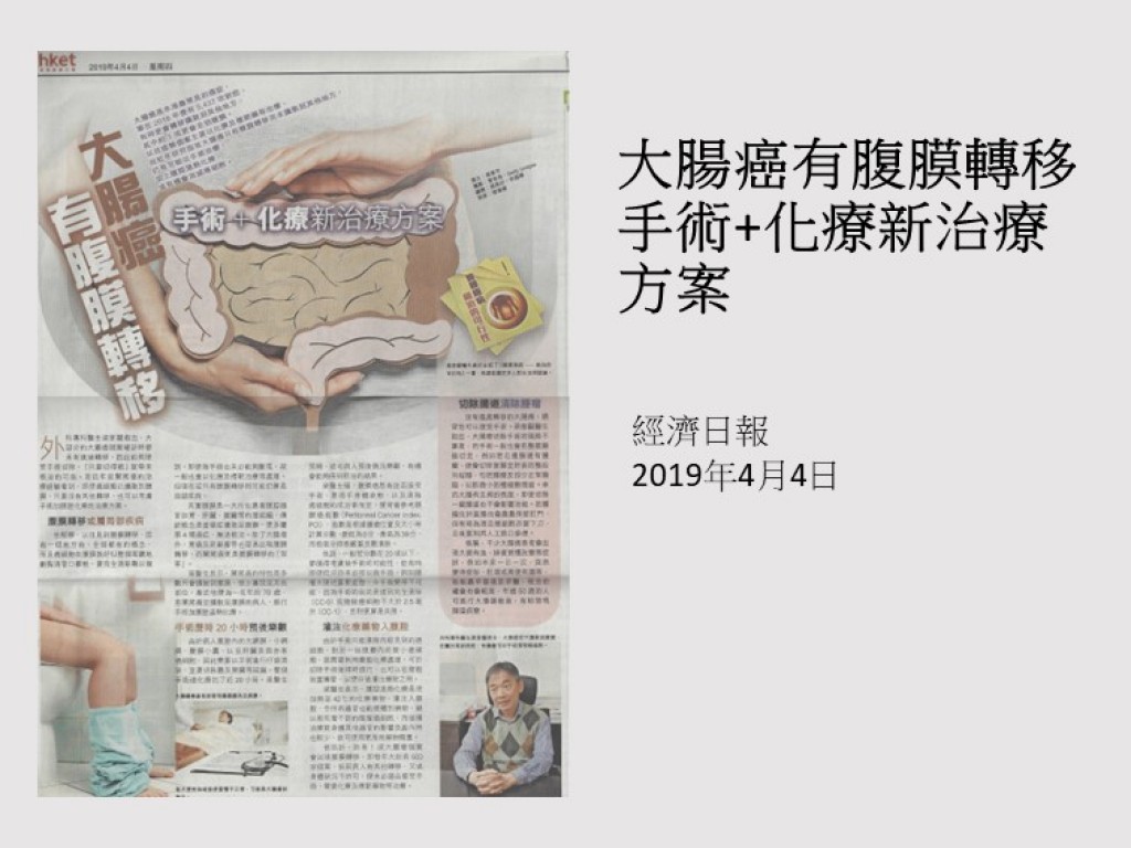 190404_大腸癌有腹膜轉移_手術化療新治療方案_經濟日報
