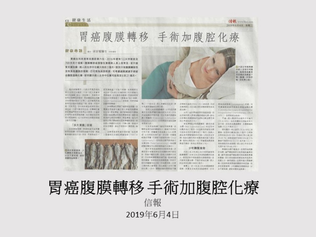 190604_胃癌腹膜轉移_手術加腹腔化療_信報