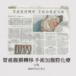 190604_胃癌腹膜轉移_手術加腹腔化療_信報