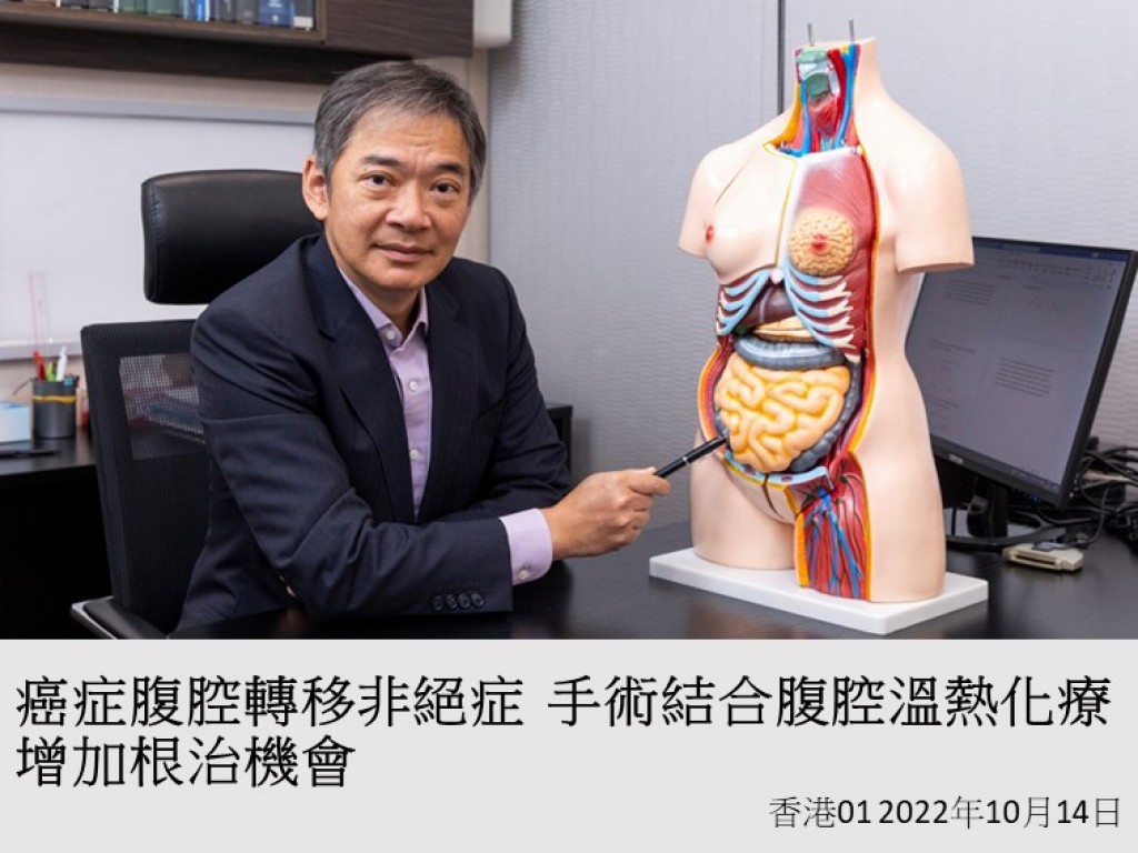 221014_癌症腹腔轉移非絕症_手術結合腹腔溫熱化療_增加根治機會_香港01