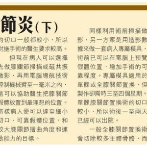 osteoarthritis.knee.2